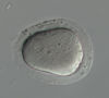 Multipronucleate embryo with no polar body