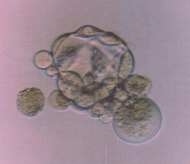Early blastocyst without zona pellucida