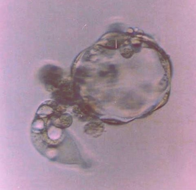 Expanded blastocyst without zona pellucida