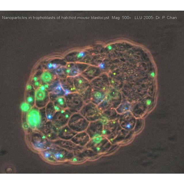 Nanoparticles in Trophoblast Cells. Mag.: 500 x