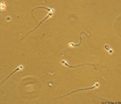 Sperm adhering to surface
