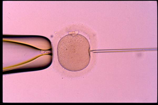 MII Oocyte just before ICSI .The sperm is postioned in the injecting pipette moving toward the tip of the needle.