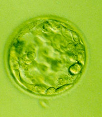 Young Blastocyst day 5