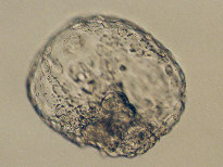Hatched Human Blastocyst, day 6