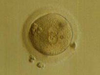 Human 2PN zygote form unstimulated cycle IVF-ET program using immature oocyte.