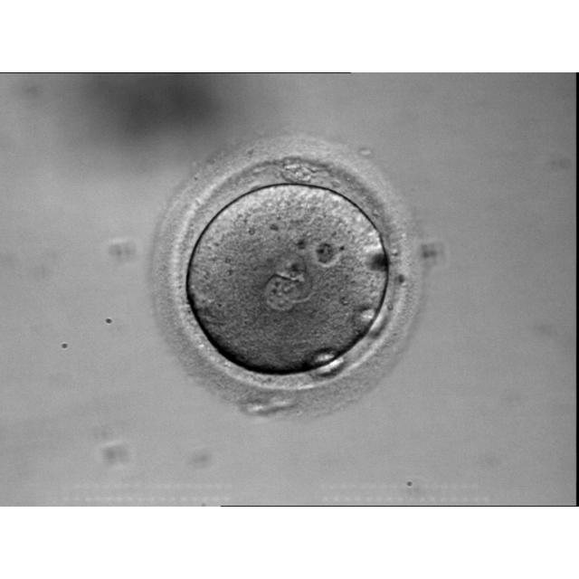 This egg was suspected to be diploid because after injection with one sperm , a 3PN zygote resulted.