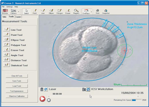 Cronus - Video Capture and Embryo Analysis Software