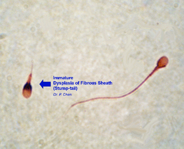 Immature stump-tail sperm