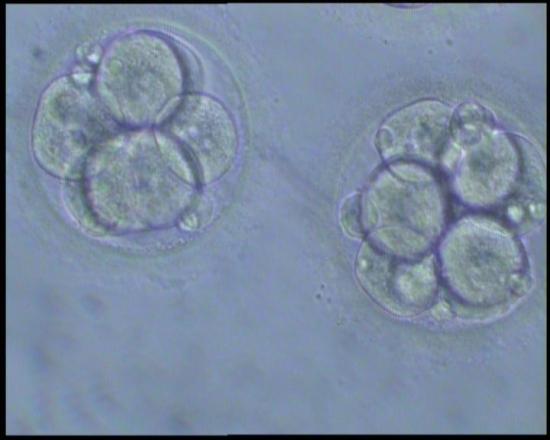 gradeembryos