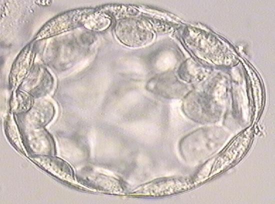 Day 5, zona free egg become blastocyst.