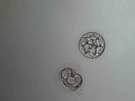 day-4 embryo from frosen DO
