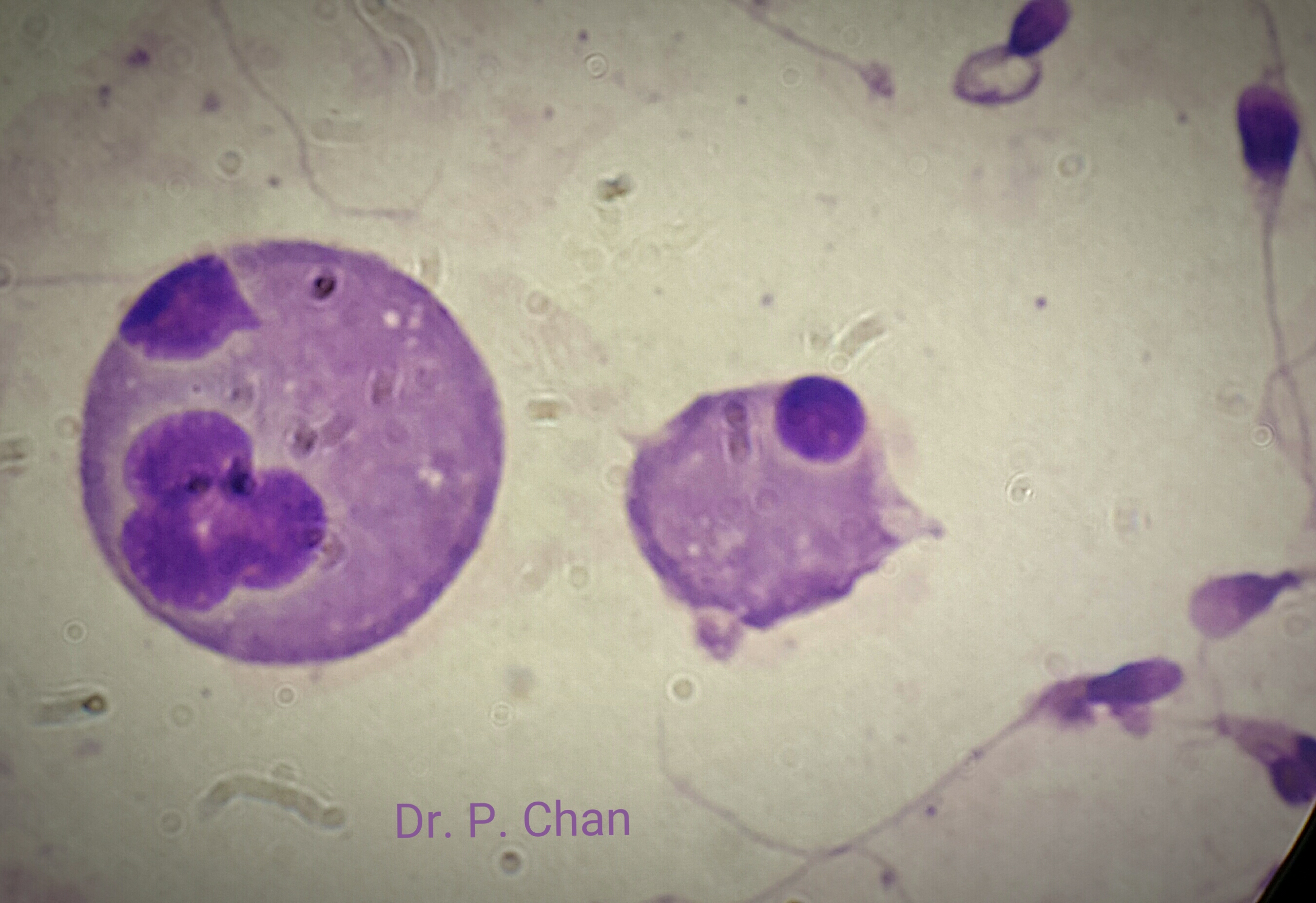 Four unseparated sperm nuclei.