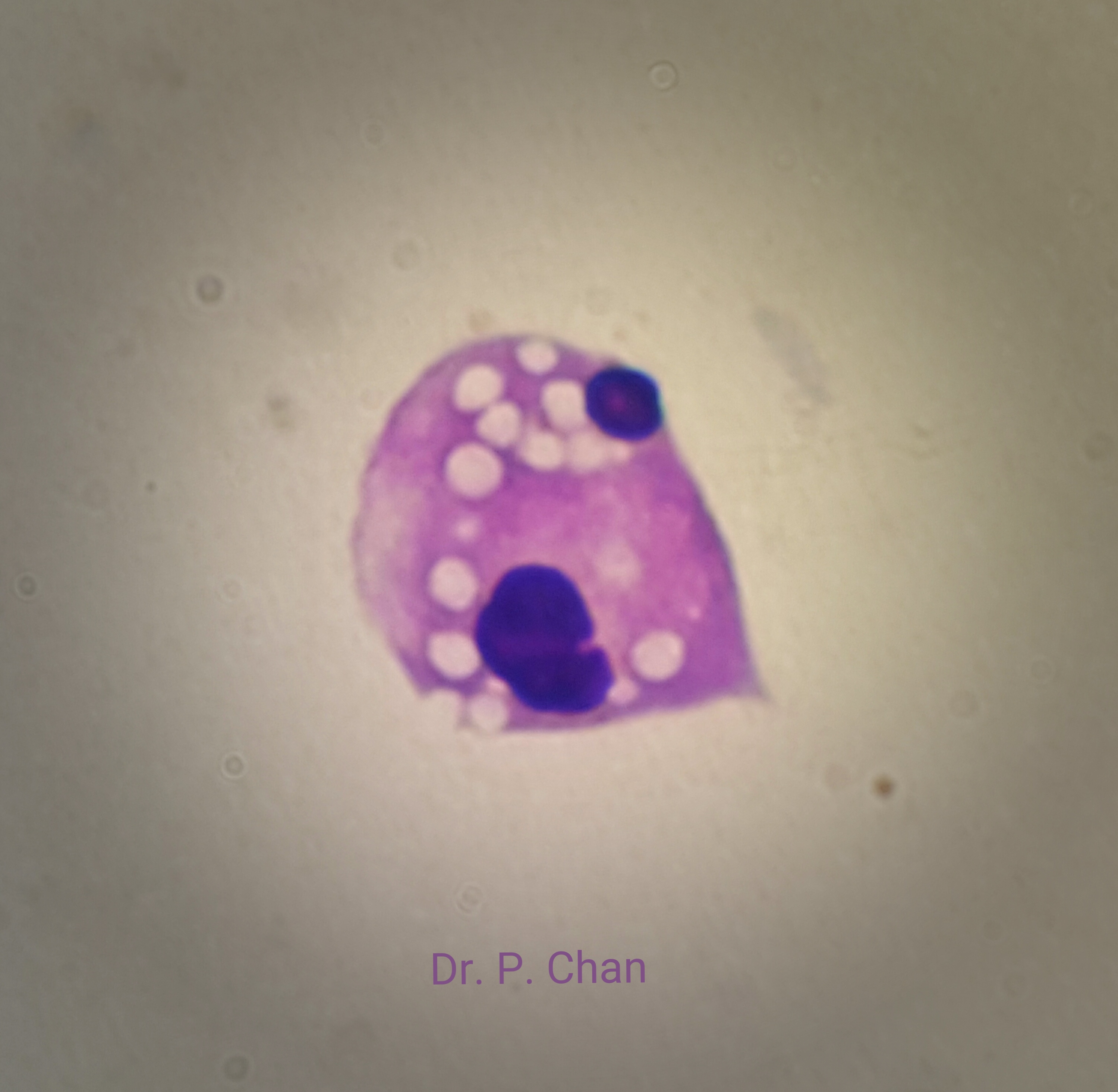 Three unseparated sperm nuclei with vacuoles.