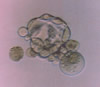 Blastocyst from egg without zona pellucida