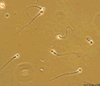 Zeta potential of sperm