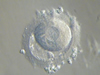 Vacuolized mature oocyte