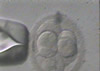 Embryo Biopsy Technique