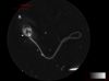 Native Assessment of Sperm Ultramorphology (NASUM)