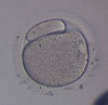 Oocyte with Large Polar Body