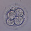 Eight Cell stage Embryo