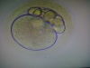 Zygote with multiple polar bodies